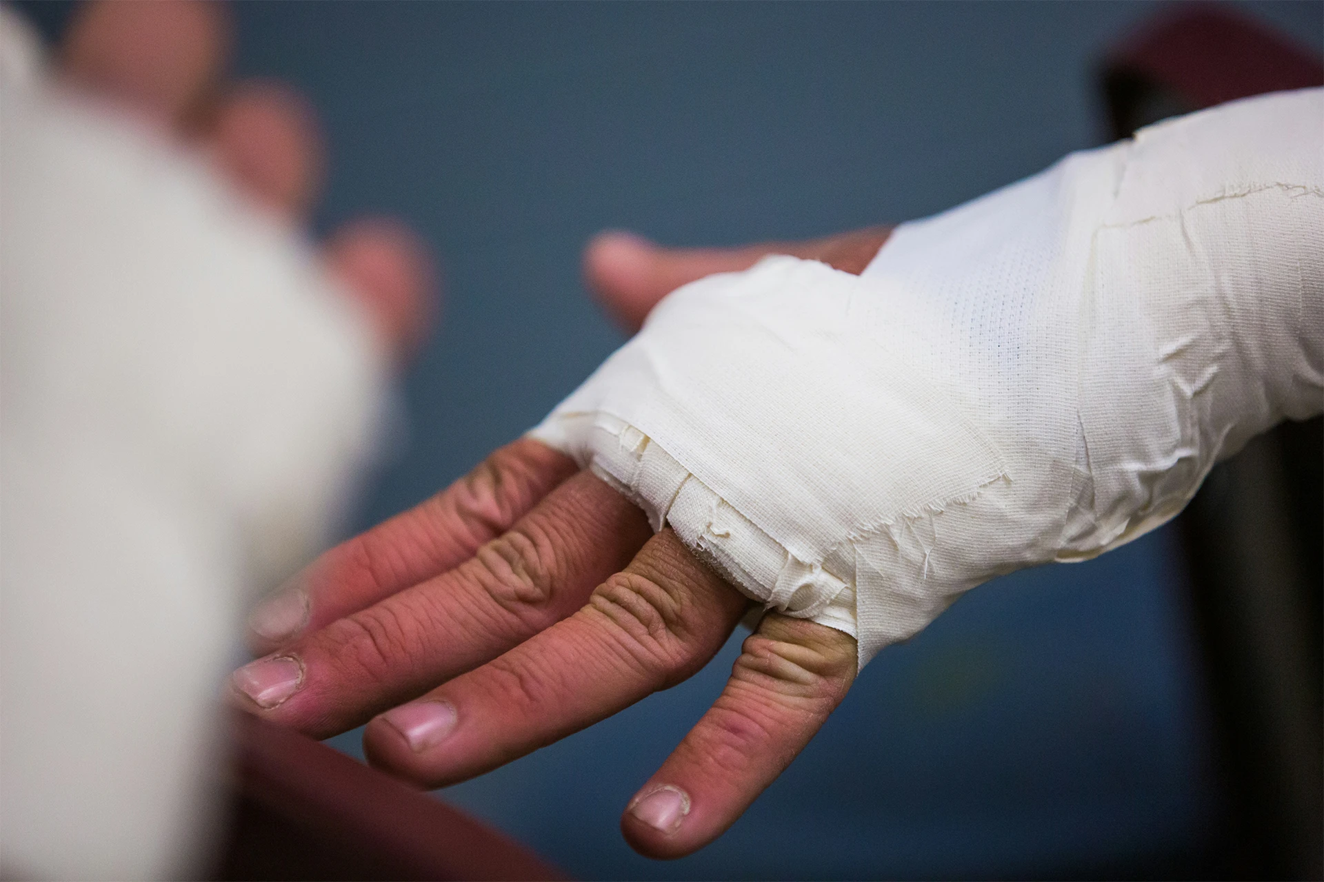 Handverletzung